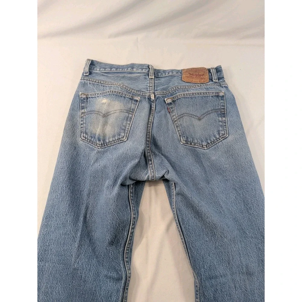 Levis stains discoloration